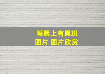 嘴唇上有黑斑图片 图片欣赏